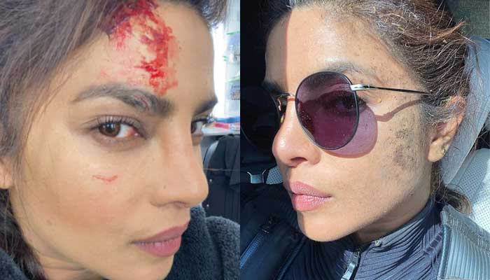 884562 9471472 Priyanka injured main updates Priyanka Chopra was injured during the shooting of the film, the actress has given birth to a daughter in the last 3 months.