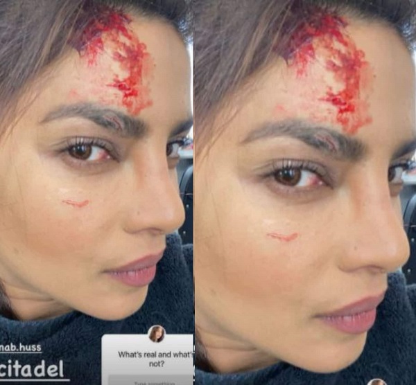 priyanka 1 Priyanka Chopra was injured during the shooting of the film, the actress has given birth to a daughter in the last 3 months.